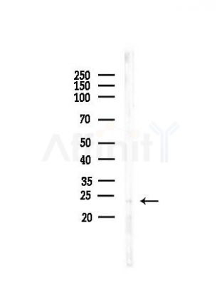 CIB4 Antibody - Western blot analysis of lysates from COLO205 cells(heat-shock, 45min treatment), using CIB4 Antibody at 1/1000 dilution.