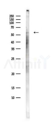 CaMKII delta Antibody - Western blot analysis of lysates from Hela cells(starvation,24h treatment), using CaMKII delta Antibody at 1/1000 dilution.
