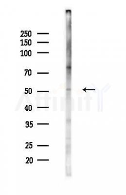CaMKII delta Antibody - Western blot analysis of lysates from LoVo cells(heat-shock,45min treatment), using CaMKII delta Antibody at 1/1000 dilution.