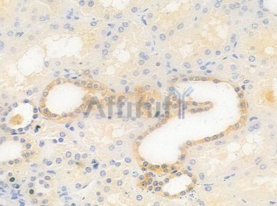 CABP3 Antibody - DF9306 at 1/100 staining human normal kidney tissue by IHC-P.