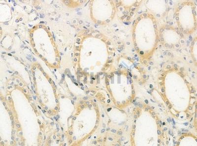 CABP3 Antibody - DF9306 at 1/100 staining human normal kidney tissue by IHC-P.
