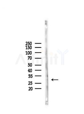 CABP4 Antibody - Western blot analysis of lysates from Mouse liver, using CABP4 Antibody at 1/1000 dilution.