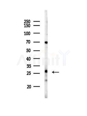 CABP5 Antibody - Western blot analysis of lysates from HepG2 cells(starvation,24h treatment), using CABP5 Antibody at 1/1000 dilution.