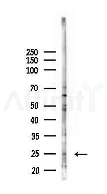 CALML6 Antibody - Western blot analysis of lysates from RAW264.