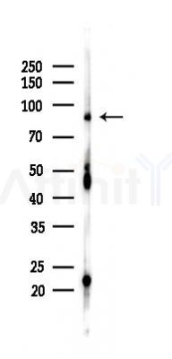CAPN13 Antibody - Western blot analysis of lysates from HepG2 cells(heat-shock,45min treatment), using CAPN13 Antibody at 1/1000 dilution.