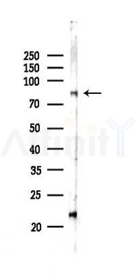 CAPN13 Antibody - Western blot analysis of lysates from COLO205 cells(LPS,4h treatment), using CAPN13 Antibody at 1/1000 dilution.