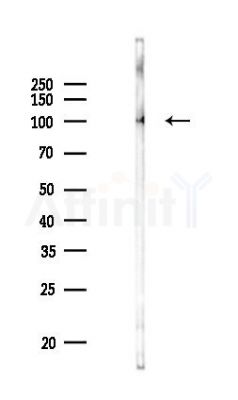 PDE2A Antibody - Western blot analysis of lysates from Rat lung, using PDE2A Antibody at 1/1000 dilution.