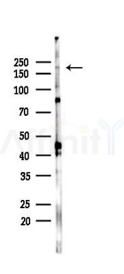 CHD2 Antibody - Western blot analysis of lysates from HepG2 cells(heat-shock,45min treatment), using CHD2 Antibody at 1/1000 dilution.