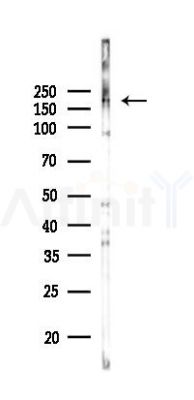 CHD2 Antibody - Western blot analysis of lysates from COLO205 cells(LPS,4h treatment), using CHD2 Antibody at 1/1000 dilution.