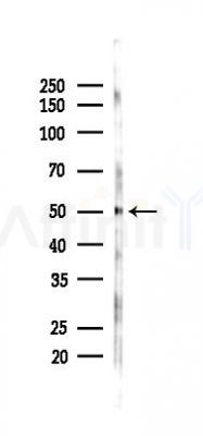 LUC7L3 Antibody - Western blot analysis of lysates from HepG2 cells(heat-shock,45min treatment), using LUC7L3 Antibody at 1/1000 dilution.