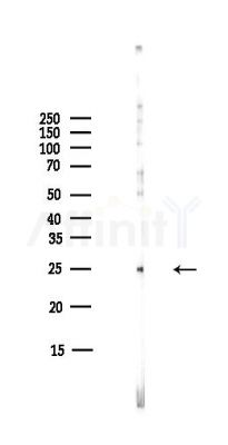 Claudin 12 Antibody - Western blot analysis of lysates from COLO205 cells(heat-shock,45min treatment), using Claudin 12 Antibody at 1/1000 dilution.