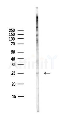 CLDN18 Antibody - Western blot analysis of lysates from COLO205 cells(heat-shock,45min treatment), using CLDN18 Antibody at 1/1000 dilution.