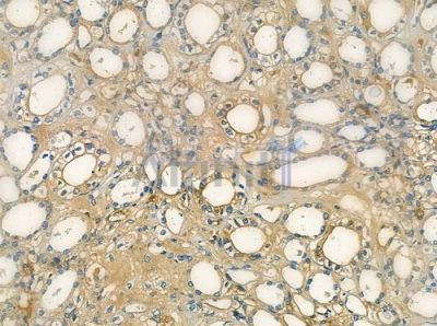 CLASP2 Antibody - DF9398 at 1/100 staining human normal kidney tissue by IHC-P.