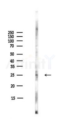 Factor D/CFD Antibody - Western blot analysis of lysates from COLO205 cells(heat-shock,45min treatment), using Factor D/CFD Antibody at 1/1000 dilution.