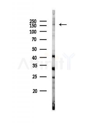 CNTNAP1 Antibody - Western blot analysis of lysates from HepG2 cells(starvation,24h treatment), using CNTNAP1 Antibody at 1/1000 dilution.