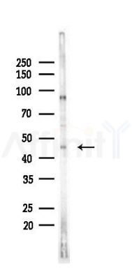 HSD11B2 Antibody - Western blot analysis of lysates from HepG2 cells(heat-shock,45min treatment), using HSD11B2 Antibody at 1/1000 dilution.