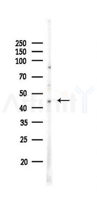 HSD11B2 Antibody - Western blot analysis of lysates from COLO205 cells(LPS,4h treatment), using HSD11B2 Antibody at 1/1000 dilution.