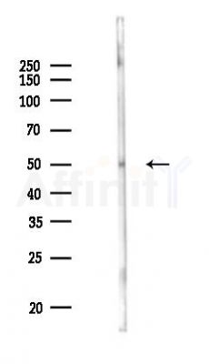 CTH Antibody - Western blot analysis of lysates from Rat lung, using CTH Antibody at 1/1000 dilution.