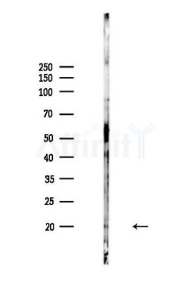CST5 Antibody - Western blot analysis of lysates from MDA-MB-231 cells(heat-shock,45min treatment), using CST5 Antibody at 1/1000 dilution.