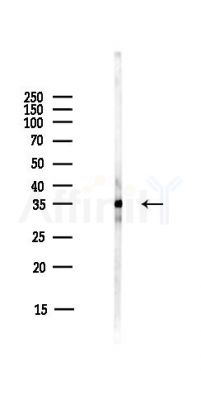 DHRS7 Antibody - Western blot analysis of lysates from HUVEC cells(starvation,24h treatment), using DHRS7 Antibody at 1/1000 dilution.