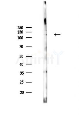 ASAP2 Antibody - Western blot analysis of lysates from MDA-MB-231 cells(heat-shock,45min treatment), using ASAP2 Antibody at 1/1000 dilution.