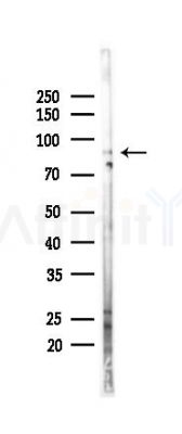 DLG3 Antibody - Western blot analysis of lysates from HepG2 cells(heat-shock,45min treatment), using DLG3 Antibody at 1/1000 dilution.
