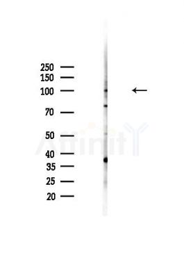 IGHMBP2 Antibody - Western blot analysis of lysates from MDA-MB-231 cells(heat-shock,45min treatment), using IGHMBP2 Antibody at 1/1000 dilution.