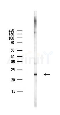 RPB7 Antibody - Western blot analysis of lysates from COLO205 cells(heat-shock,45min treatment), using RPB7 Antibody at 1/1000 dilution.