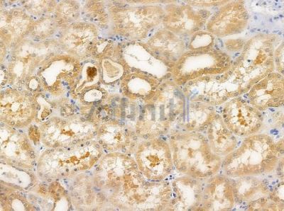 DYNLT1 Antibody - DF9473 at 1/100 staining human normal kidney tissue by IHC-P.