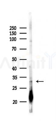 NSMCE2 Antibody - Western blot analysis of lysates from COLO205 cells(LPS,4h treatment), using NSMCE2 Antibody at 1/1000 dilution.