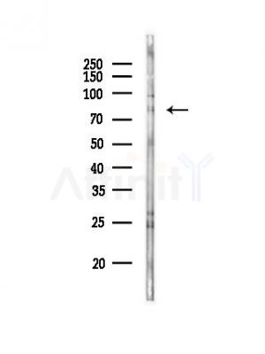 CD248 Antibody - Western blot analysis of lysates from HepG2 cells(starvation,24h treatment), using CD248 Antibody at 1/1000 dilution.