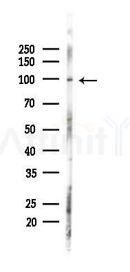 EIF2C3 Antibody - Western blot analysis of lysates from HepG2 cells(heat-shock,45min treatment), using EIF2C3 Antibody at 1/1000 dilution.