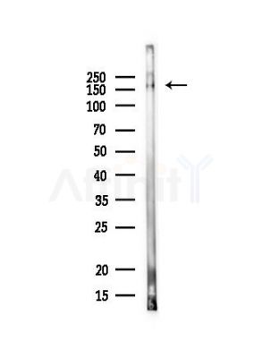 GPATCH8 Antibody - Western blot analysis of lysates from Mouse muscle, using GPATCH8 Antibody at 1/1000 dilution.