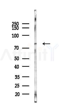 GPHN Antibody - Western blot analysis of lysates from B16F10-LUC cells(starvation,24h treatment), using GPHN Antibody at 1/1000 dilution.