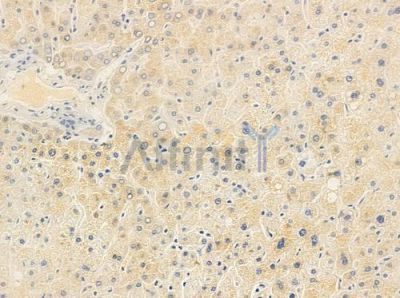 CSF3R Antibody - DF9543 at 1/100 staining human normal liver tissue by IHC-P.
