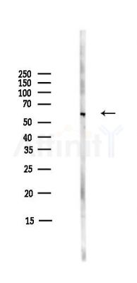 GDF6 Antibody - Western blot analysis of lysates from COLO205 cells(heat-shock,45min treatment), using GDF6 Antibody at 1/1000 dilution.