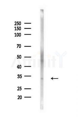 HOXA11 Antibody - Western blot analysis of lysates from LoVo cells(heat-shock,45min treatment), using HOXA11 Antibody at 1/1000 dilution.