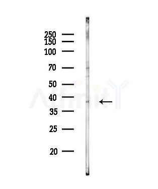 HOXC13 Antibody - Western blot analysis of lysates from A549 cells, using HOXC13 Antibody at 1/1000 dilution.