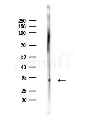 HOXD13 Antibody - Western blot analysis of lysates from LoVo cells(heat-shock,45min treatment), using HOXD13 Antibody at 1/1000 dilution.