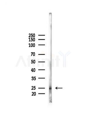 TGIF2LX Antibody - Western blot analysis of lysates from RAW264.