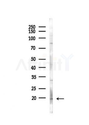 VPREB1 Antibody - Western blot analysis of lysates from PC12 cells(heat-shock,45min treatment), using VPREB1 Antibody at 1/1000 dilution.