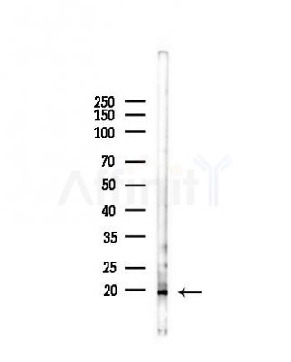 VPREB1 Antibody - Western blot analysis of lysates from RAW264.