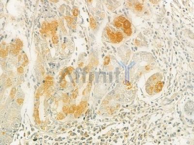 ICAM5 Antibody - DF9596 at 1/100 staining human normal gastric tissue by IHC-P.