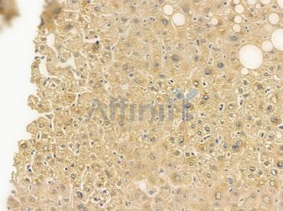 KIR2DL2 Antibody - DF9599 at 1/100 staining human normal liver tissue by IHC-P.