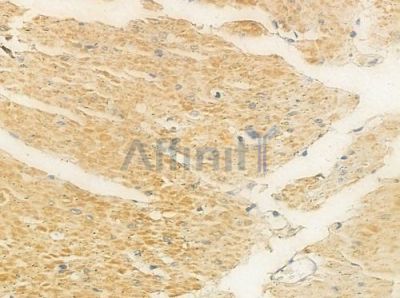 KIR2DL2 Antibody - DF9599 at 1/100 staining human normal gastric tissue by IHC-P.