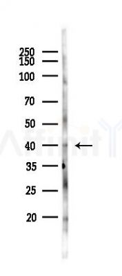 KIR2DL5A Antibody - Western blot analysis of lysates from 293 cells(UV,30min treatment), using KIR2DL5A Antibody at 1/1000 dilution.