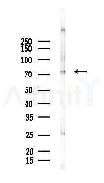 ACSL1 Antibody - Western blot analysis of lysates from Mouse liver, using ACSL1 Antibody at 1/1000 dilution.