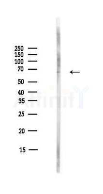 MARVELD2 Antibody - Western blot analysis of lysates from COLO205 cells(heat-shock,45min treatment), using MARVELD2 Antibody at 1/1000 dilution.
