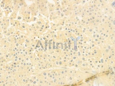 MOT11 Antibody - DF9632 at 1/100 staining human normal lung tissue by IHC-P.