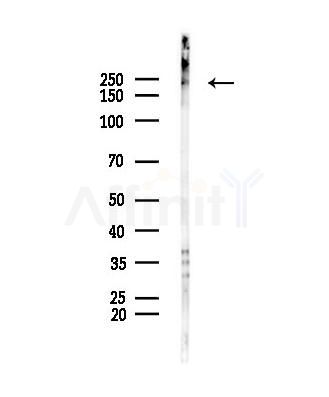 MYH3 Antibody - Western blot analysis of lysates from Mouse lung, using MYH3 Antibody at 1/1000 dilution.